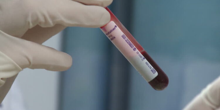 researchers-identify-blood-test-that-could-detect-ovarian-cancer-early