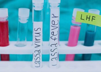 Nigeria records 200 deaths from Lassa fever so far in 2023