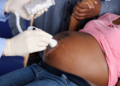 Why more Nigerian women are opting for C-Section despite rising cost  